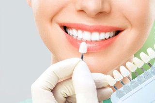 blanqueamiento-dental-clinica-dental-orissana-www.orissana.com